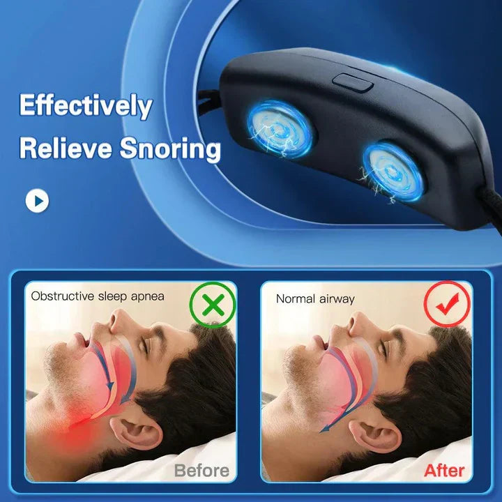 Electronic Anti-Snoring Device | EMS Pulse Vibration | Portable Design &amp; USB Rechargeable